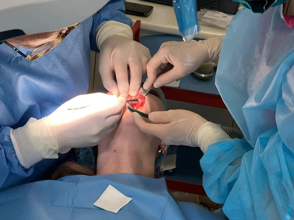 Costurile implantului dentar. În serviciile medicale stomatologice, mai ieftin înseamnă întotdeauna mai puțin! – foto 6